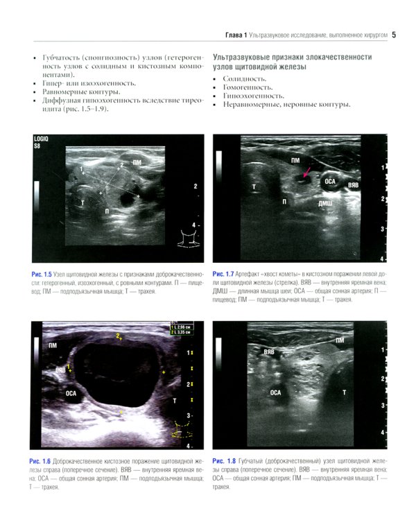 Атлас эндокринной хирургии