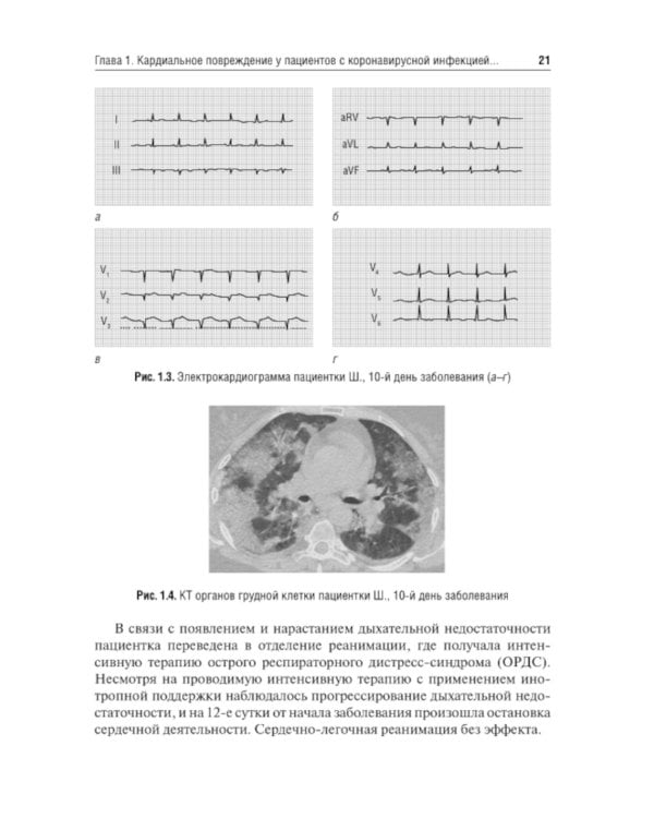 Трудный пациент с COVID-19. Междисциплинарный подход: Учебное пособие