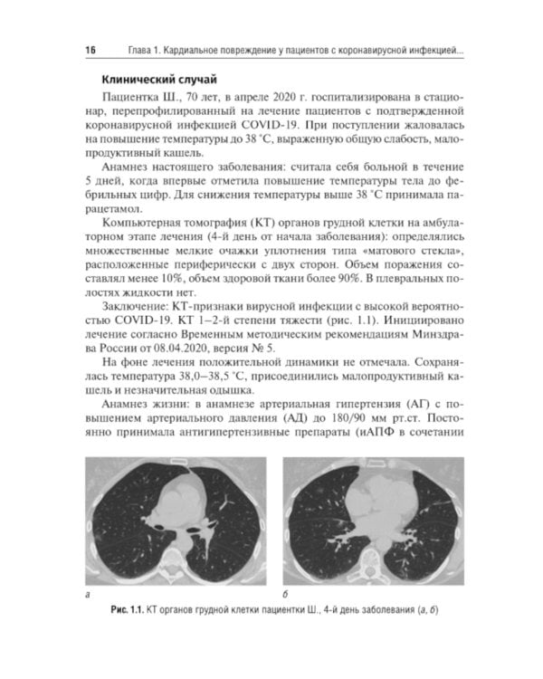 Трудный пациент с COVID-19. Междисциплинарный подход: Учебное пособие