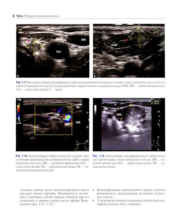Атлас эндокринной хирургии