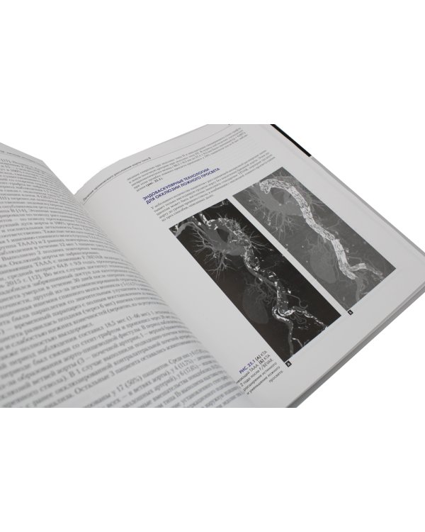 Расслоение аорты. Личные истории пациентов и достижения, спасшие им жизнь