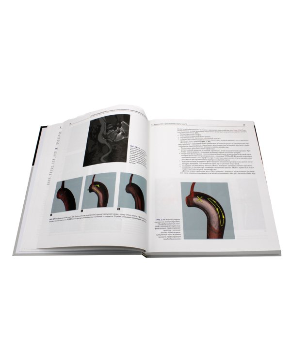 Расслоение аорты. Личные истории пациентов и достижения, спасшие им жизнь