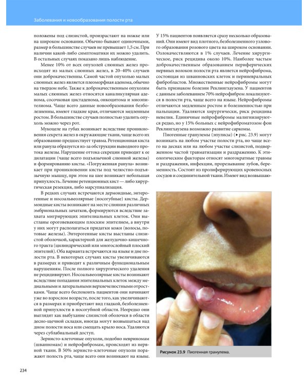 Общая оториноларингология - Хирургия головы и шеи. В 2 т