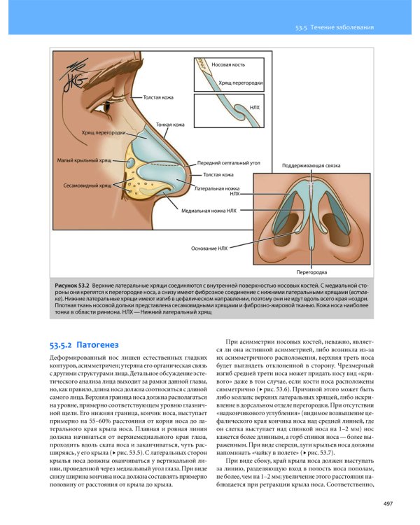 Общая оториноларингология - Хирургия головы и шеи. В 2 т