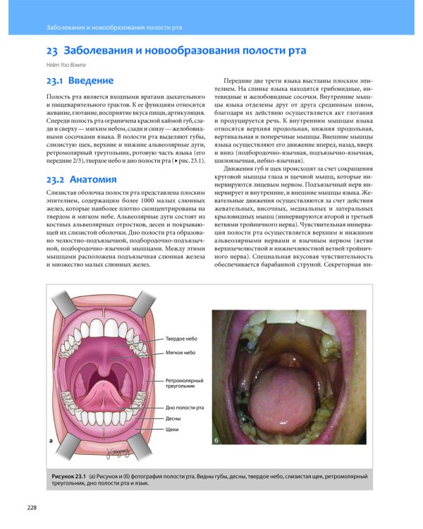 Общая оториноларингология - Хирургия головы и шеи. В 2 т