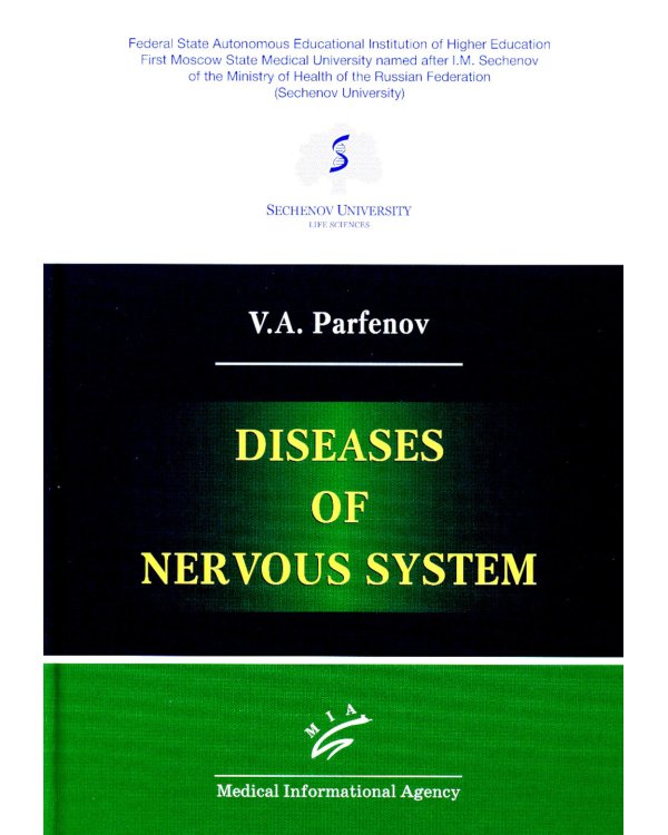 Diseases of nervous system