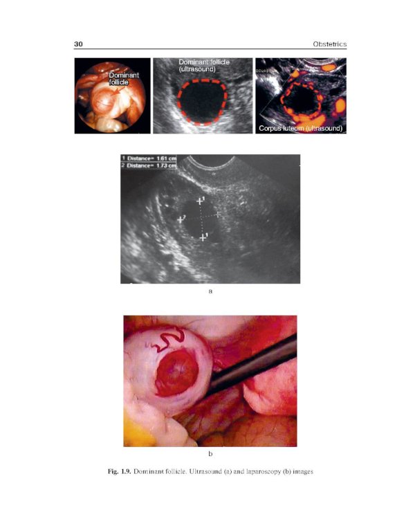Obstetrics = Акушерство: Учебник