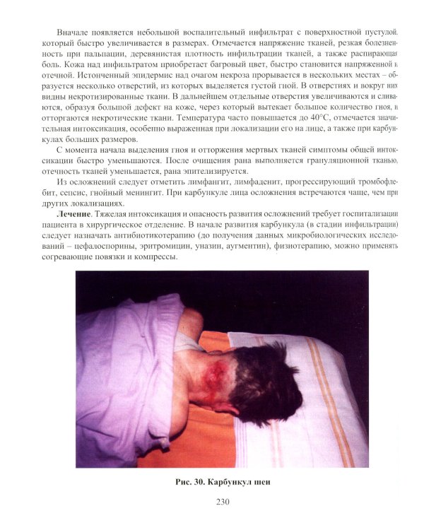 Инфекция в хирургии: Учебник. 2-е изд., перераб.и доп