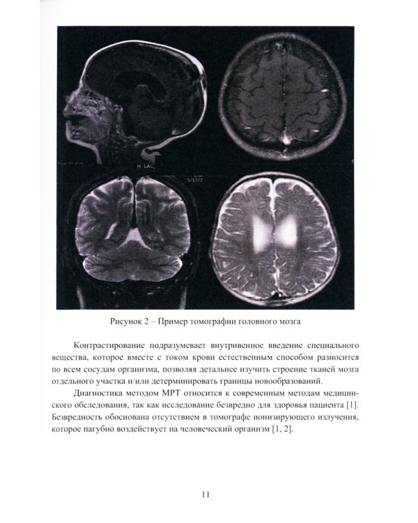 Глубокое обучение в задаче ранней диагностики деменции