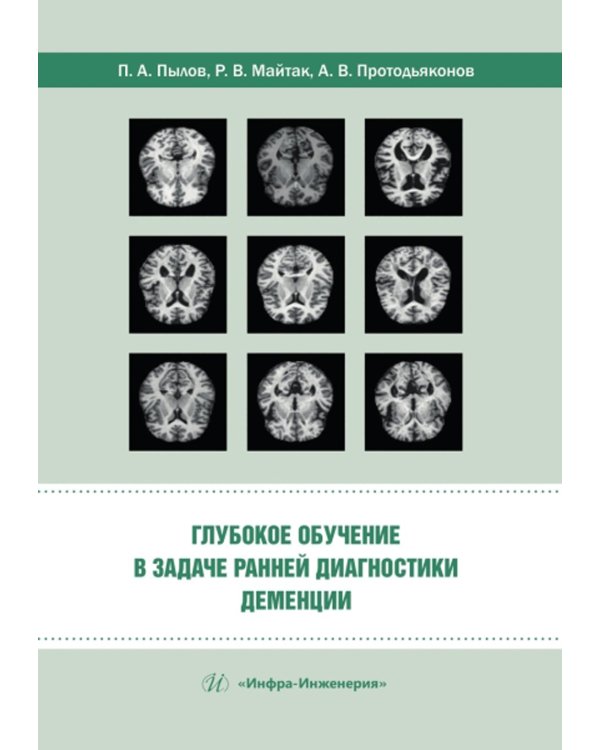 Глубокое обучение в задаче ранней диагностики деменции