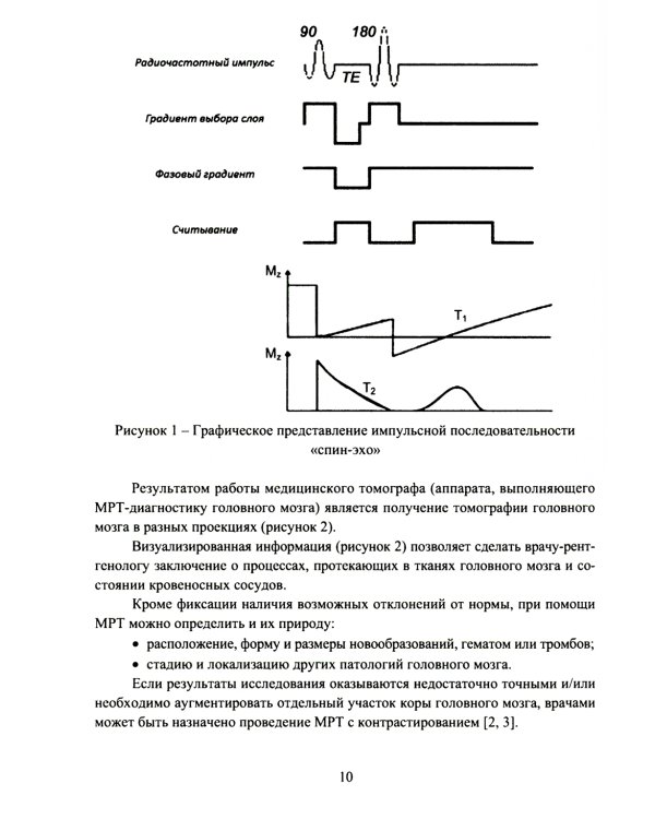 Глубокое обучение в задаче ранней диагностики деменции