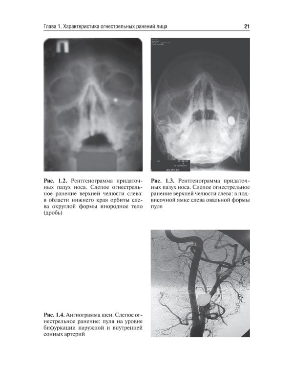 Военная стоматология и челюстно-лицевая хирургия. 2-е изд., перераб. и доп: Учебное пособие