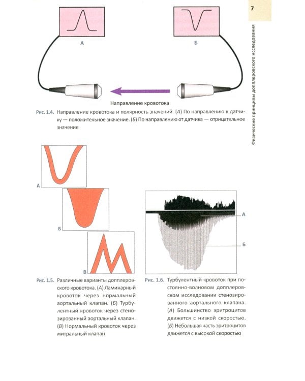 ЭхоКГ понятным языком. 3-е изд