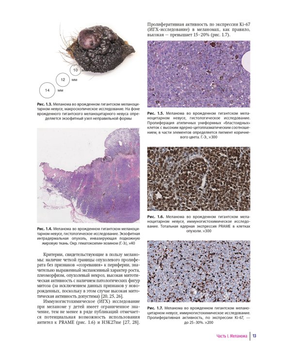 Детская дерматоонкология: руководство для врачей