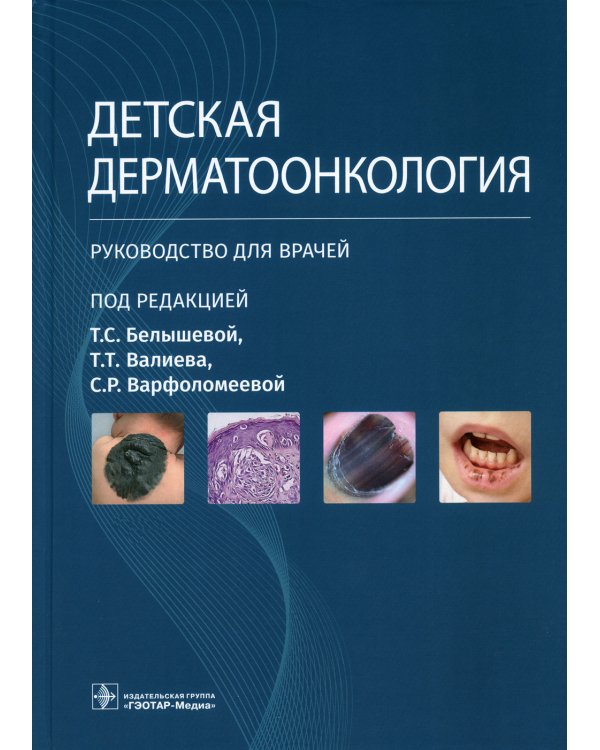 Детская дерматоонкология: руководство для врачей
