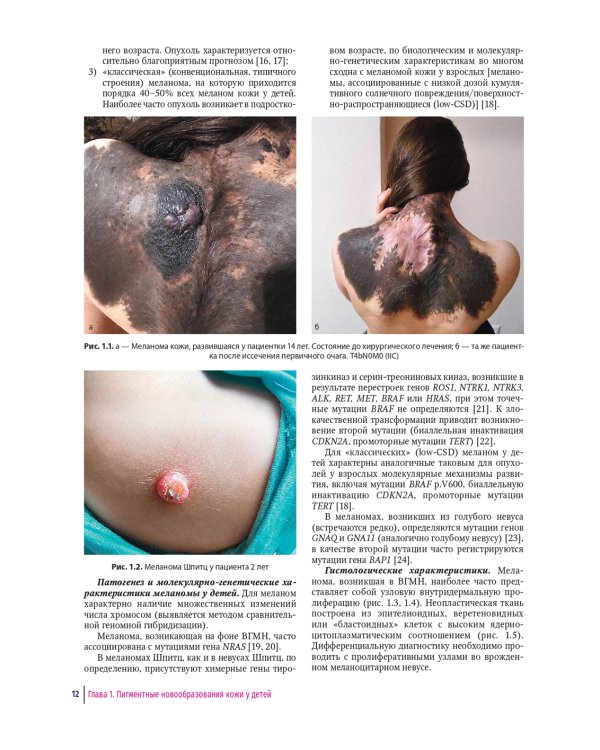 Детская дерматоонкология: руководство для врачей