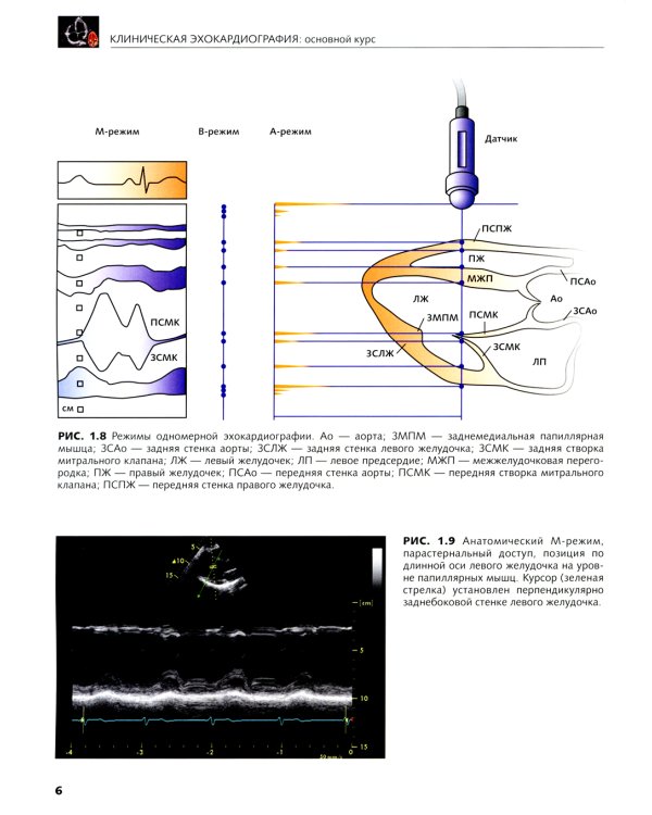 Клиническая эхокардиография: основной курс