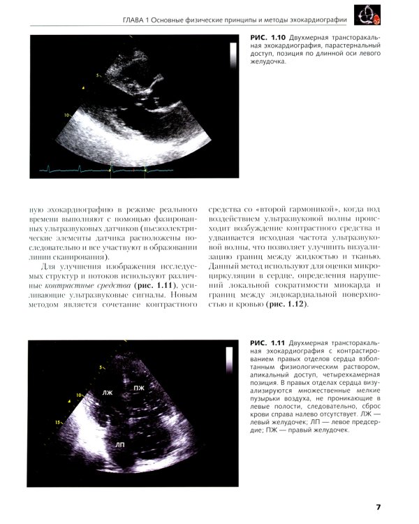 Клиническая эхокардиография: основной курс