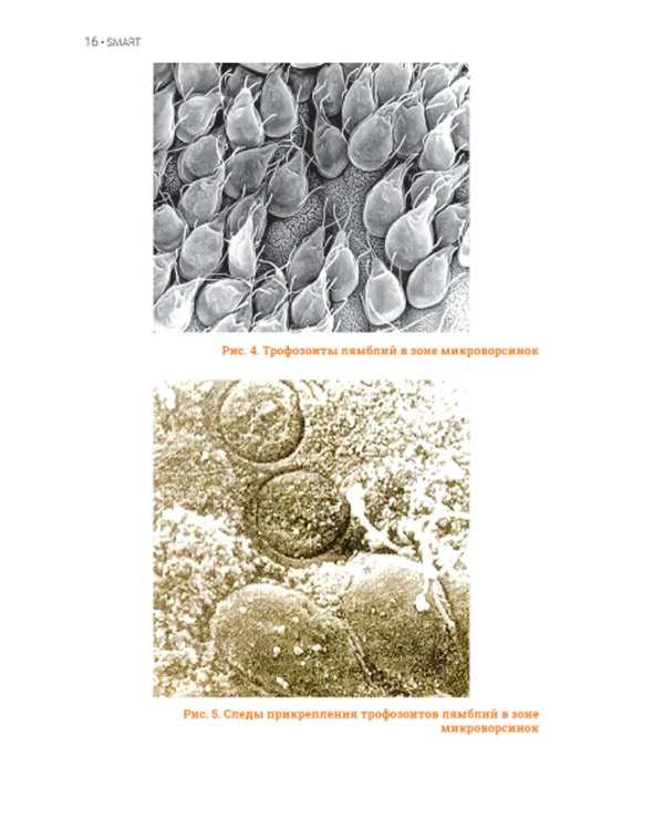 Лямблиоз: руководство для врачей