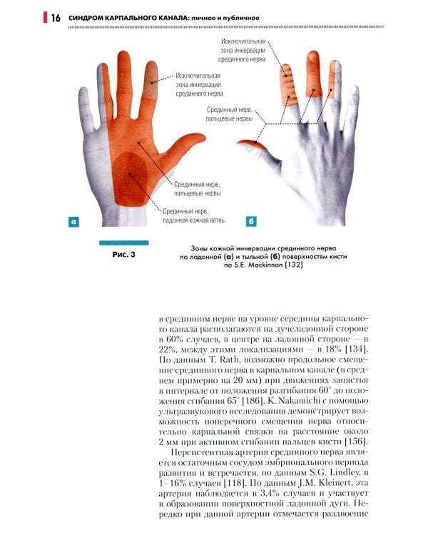 Синдром карпального канала: личное и публичное