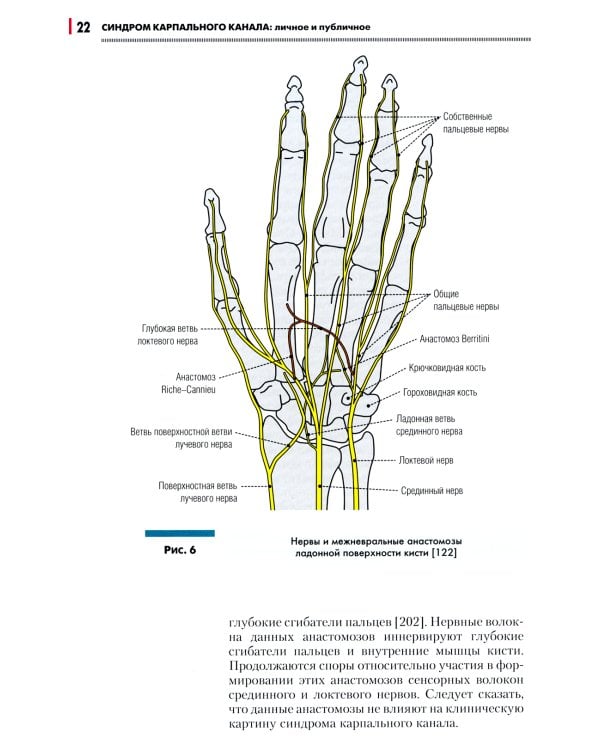 Синдром карпального канала: личное и публичное