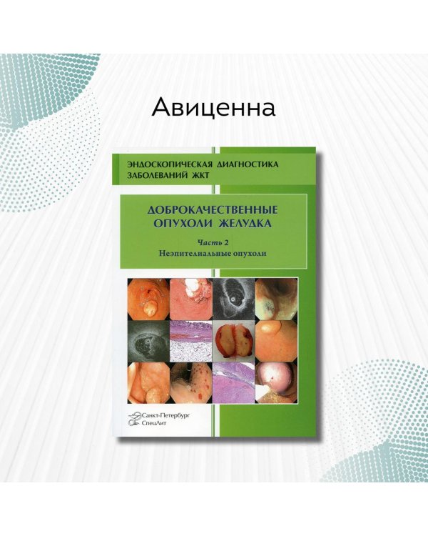 Доброкачественные опухоли желудка. Часть 2. Неэпителиальные опухоли