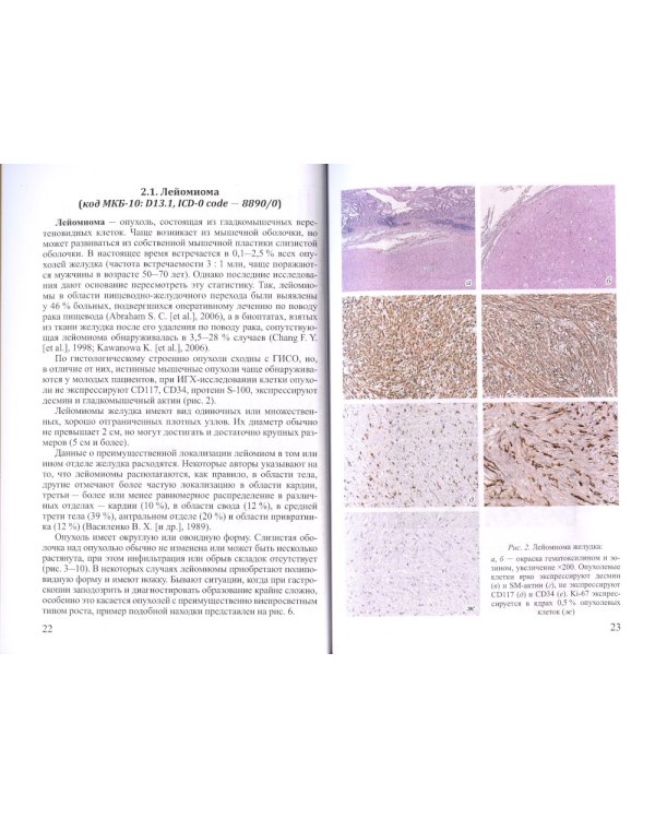 Доброкачественные опухоли желудка. Неэпителиальные  опухоли. Ч. 2: Учебно-методическое пособие