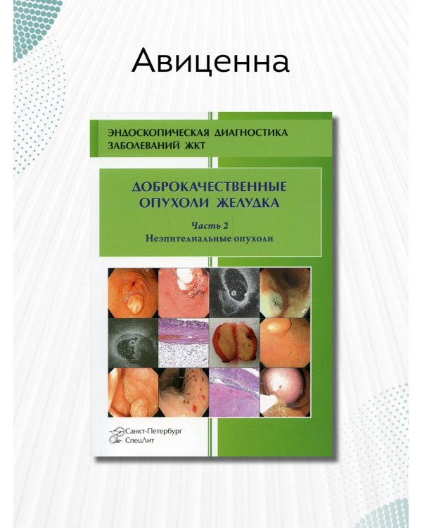 Доброкачественные опухоли желудка. Часть 2. Неэпителиальные опухоли
