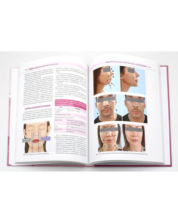 Практическое применение косметических инъекционных препаратов. Дермальные филлеры и ботулотоксин
