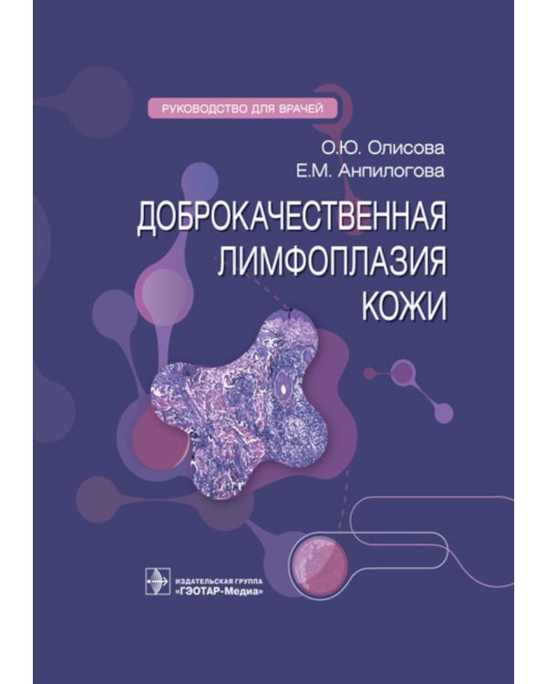 Доброкачественная лимфоплазия кожи: руководство для врачей