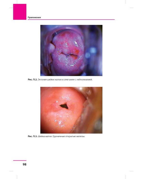Заболевания шейки матки. Современные подходы к диагностике и лечению: Учебное пособие для врачей