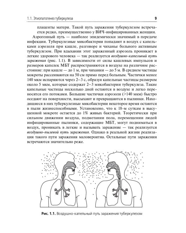 Туберкулез и беременность: Учебное пособие