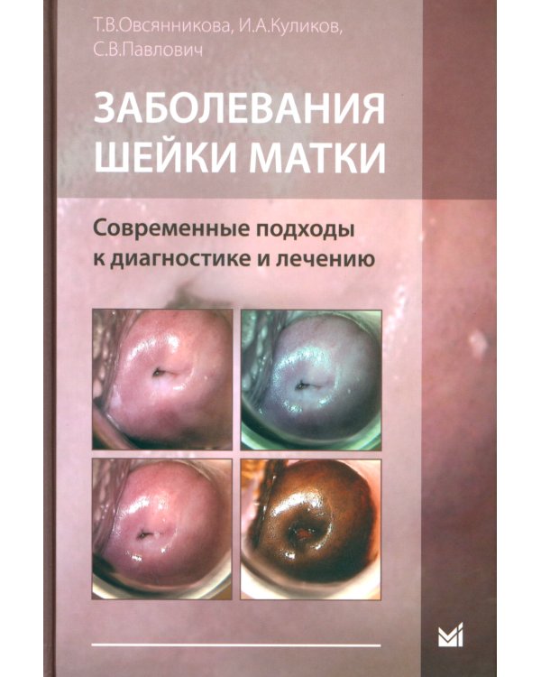 Заболевания шейки матки. Современные подходы к диагностике и лечению: Учебное пособие для врачей