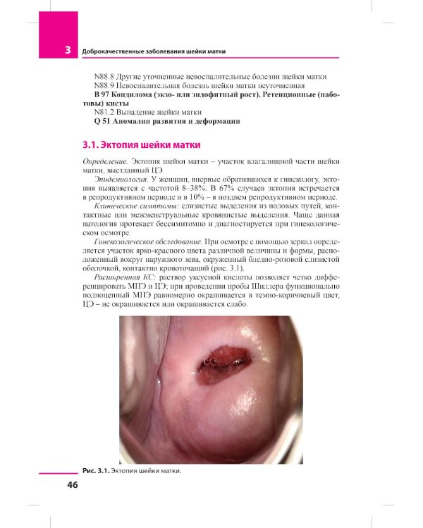 Заболевания шейки матки. Современные подходы к диагностике и лечению: Учебное пособие для врачей