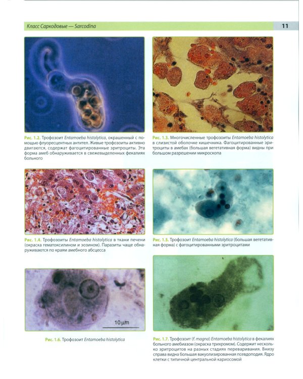 Атлас по медицинской паразитологии: Учебное пособие