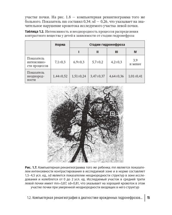 Редкие заболевания мочеполовой системы в детском возрасте