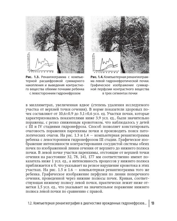 Редкие заболевания мочеполовой системы в детском возрасте