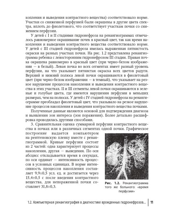 Редкие заболевания мочеполовой системы в детском возрасте