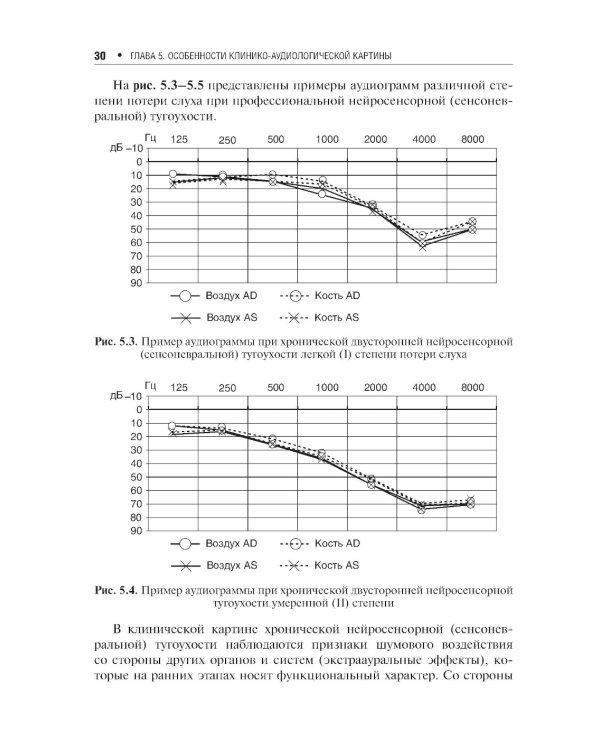 Профессиональная тугоухость: руководство для врачей. 2-е изд., перераб. и доп