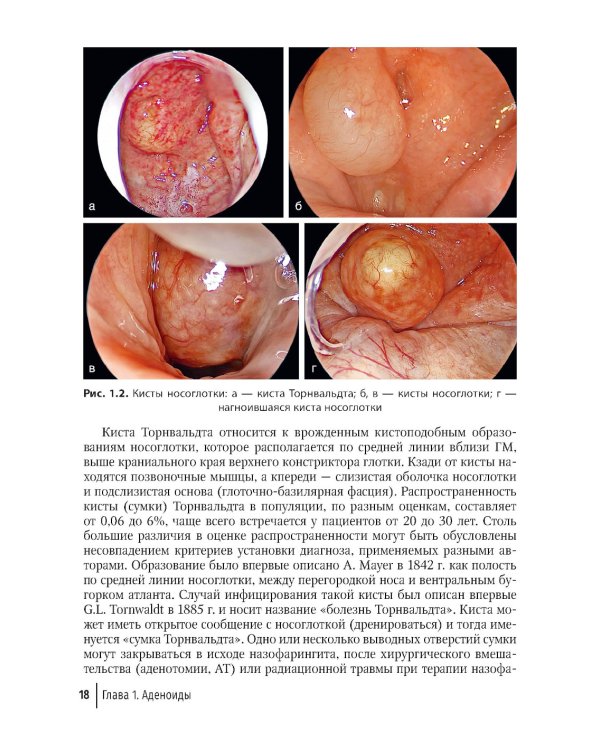 Современные подходы к диагностике и лечению патологии верхних дыхательных путей: руководство для врачей