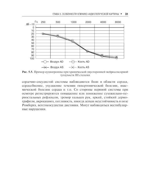 Профессиональная тугоухость: руководство для врачей. 2-е изд., перераб. и доп