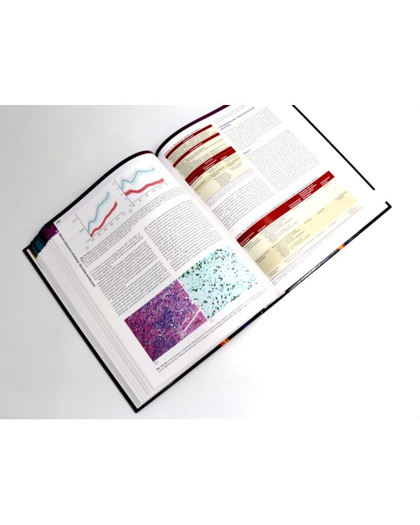 Болезни сердца по Браунвальду. Руководство по сердечно-сосудистой медицине. В 3 т. главы 1- 99 (комплект)