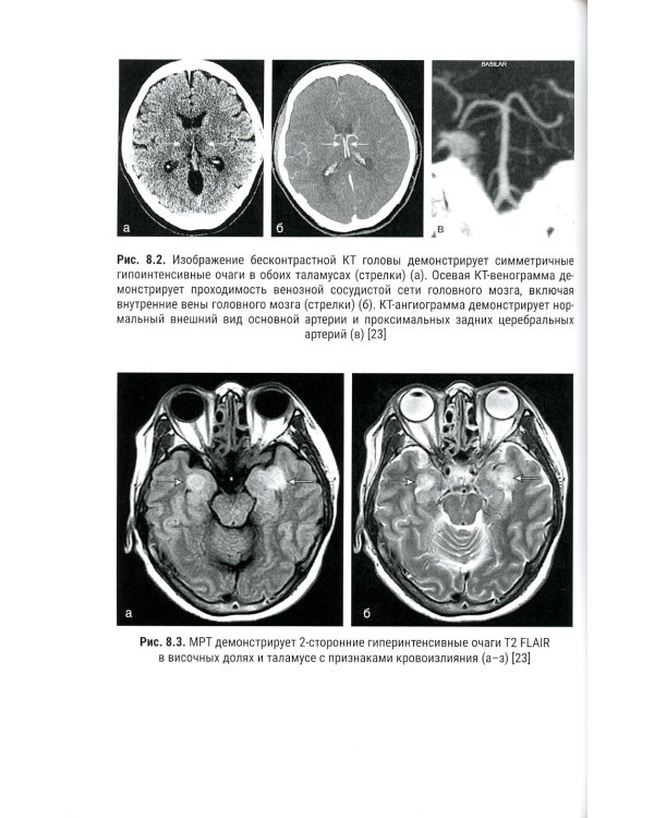 COVID-19: психические и неврологические последствия: руководство для врачей