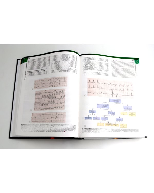 Болезни сердца по Браунвальду. Руководство по сердечно-сосудистой медицине. В 3 т. главы 1- 99 (комплект)