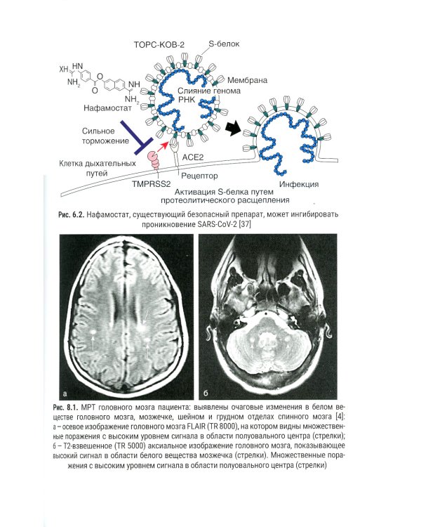 COVID-19: психические и неврологические последствия: руководство для врачей