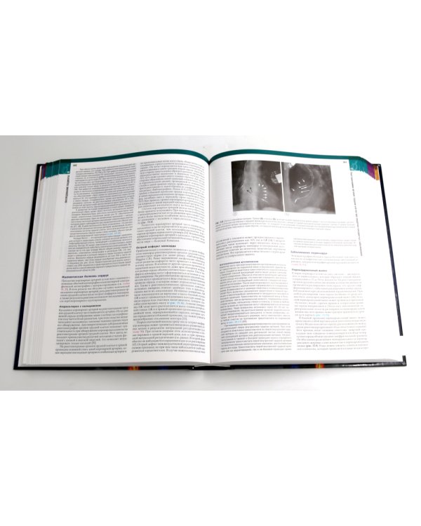 Болезни сердца по Браунвальду. Руководство по сердечно-сосудистой медицине. В 3 т. главы 1- 99 (комплект)