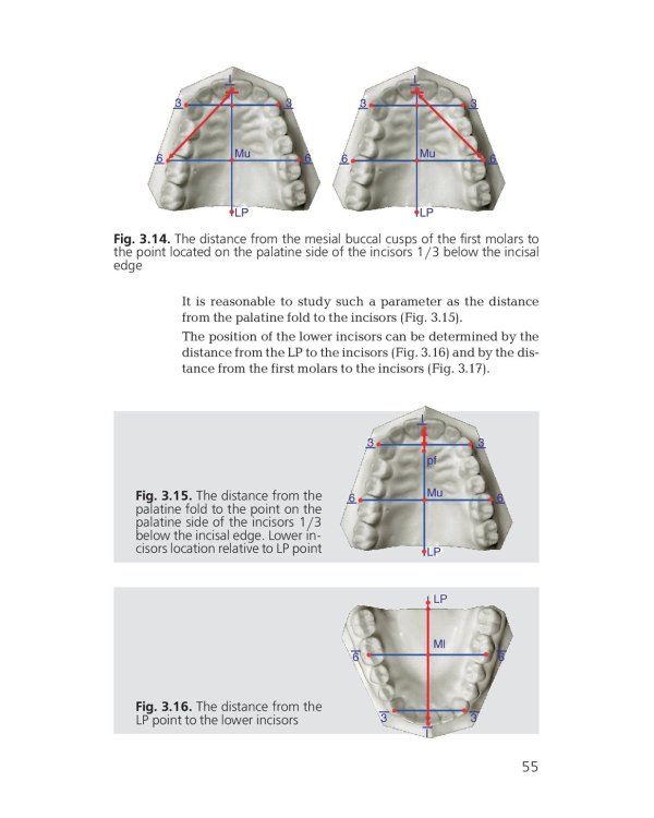 Orthodontics. Modern Methods of Diagnosing Dental Abnormalities, Dentition and Occlusion: tutorial: на англ.яз
