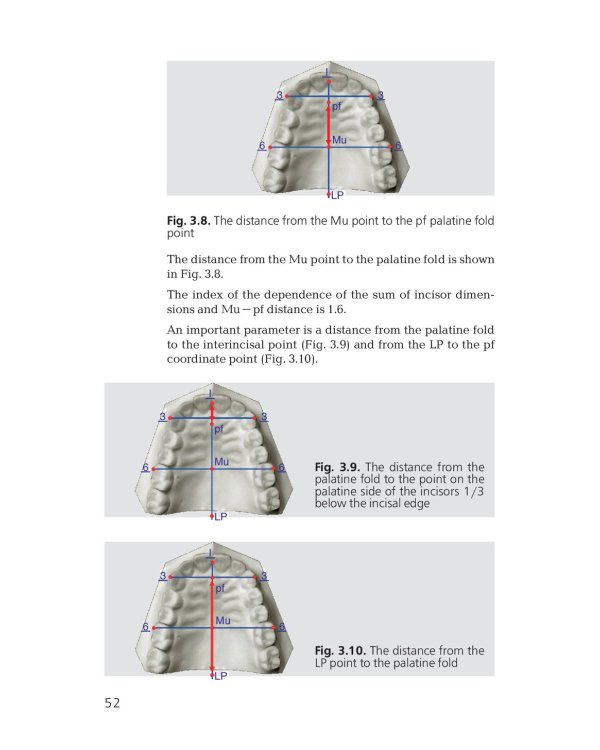 Orthodontics. Modern Methods of Diagnosing Dental Abnormalities, Dentition and Occlusion: tutorial: на англ.яз