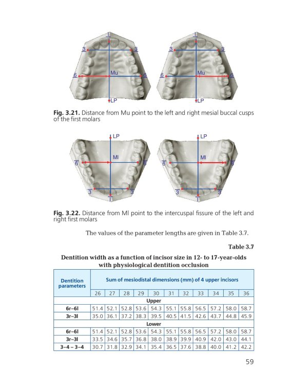 Orthodontics. Modern Methods of Diagnosing Dental Abnormalities, Dentition and Occlusion: tutorial: на англ.яз