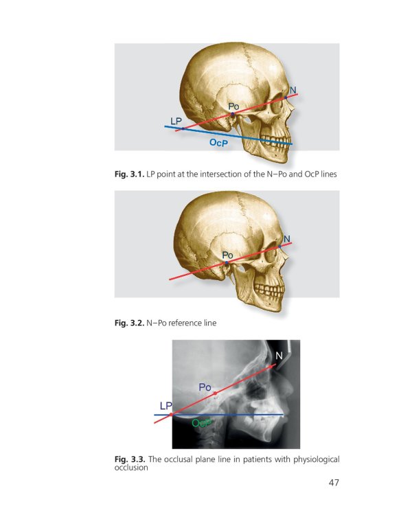 Orthodontics. Modern Methods of Diagnosing Dental Abnormalities, Dentition and Occlusion: tutorial: на англ.яз